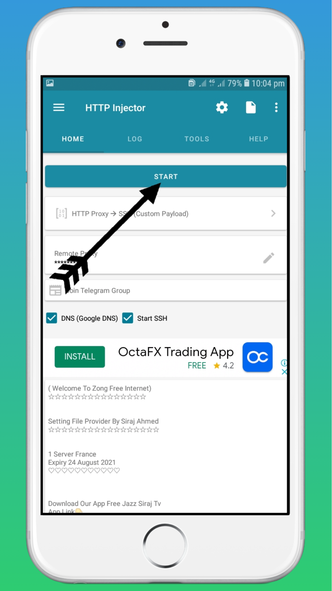 Zong Free Unlimited Free VPN Https injector Free Setting File